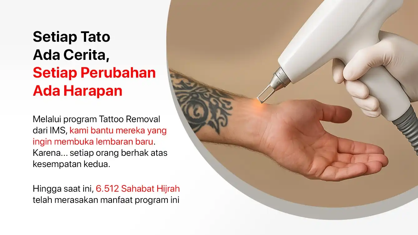 Program Tatto Removal by SNF Consulting